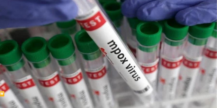 दिल्ली के बाद अब राज्य में मिला Mpox का संदिग्ध मरीज, जांच के लिए भेजा गया सैंपल