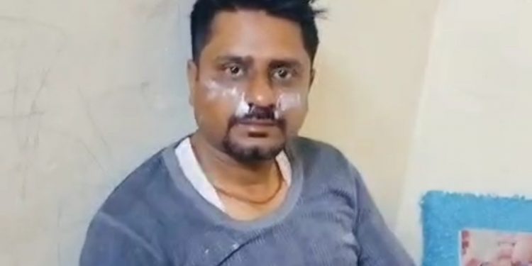 चाइनीज मांझे की चपेट में आने से बाइक सवार डॉक्टर की कट गई नाक, 10 टांके लगे