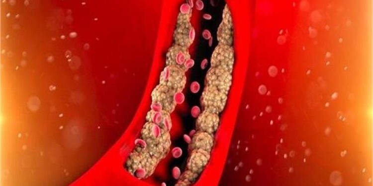 Health Alert: ये 5 चीजें खाने से नसों के जड़ से भी निकलेगा खराब कोलेस्ट्रॉल